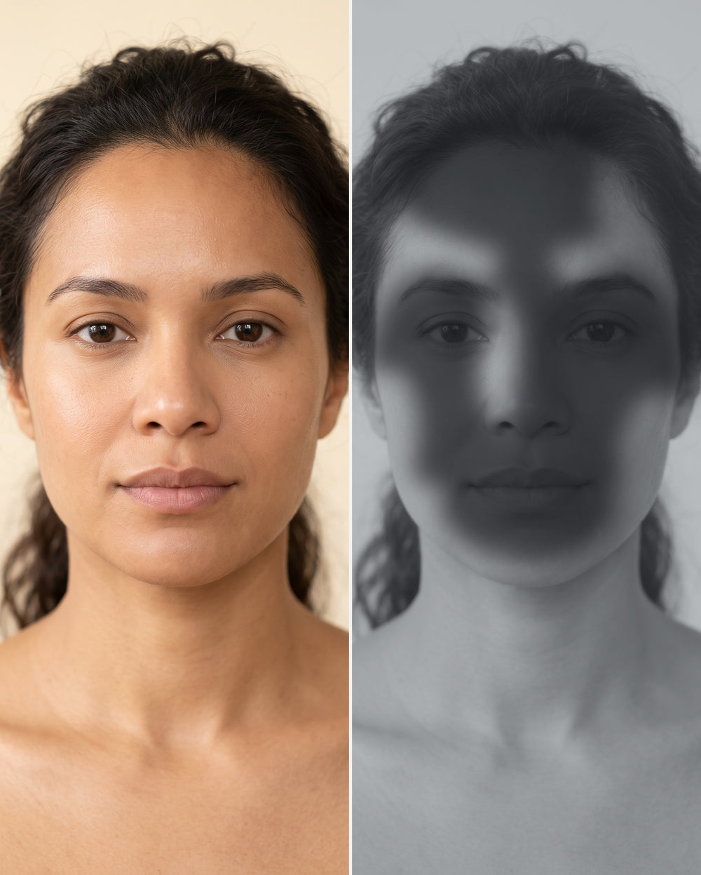 Illustrative natural-light and UV-screen appearance of uneven sunscreen coverage